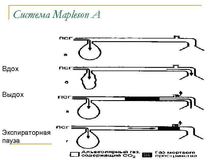 Система Mapleson A Вдох Выдох Экспираторная пауза 