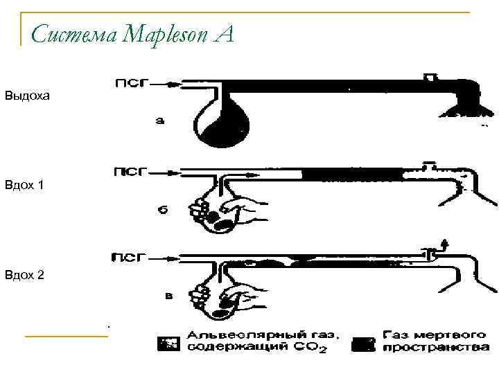 Система Mapleson A Выдоха Вдох 1 Вдох 2 