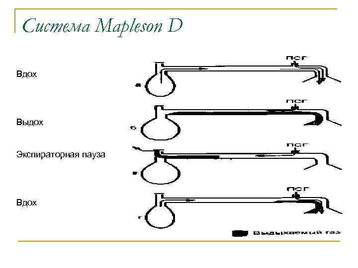 Система Mapleson D Вдох Выдох Экспираторная пауза Вдох 