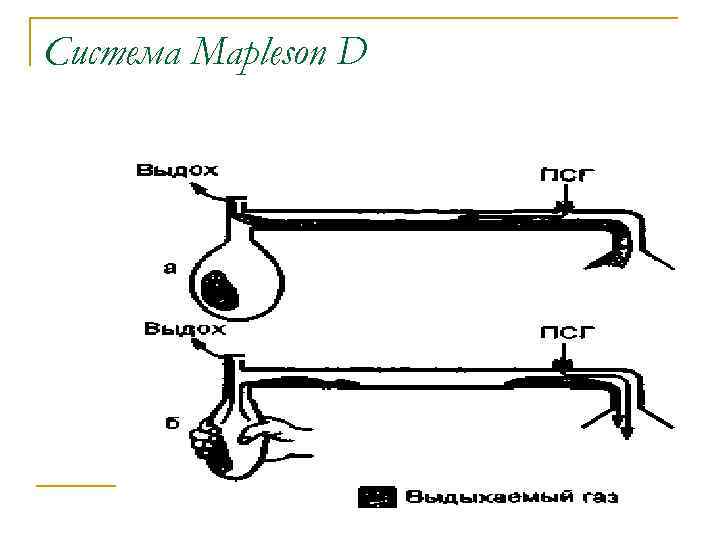 Система Mapleson D 