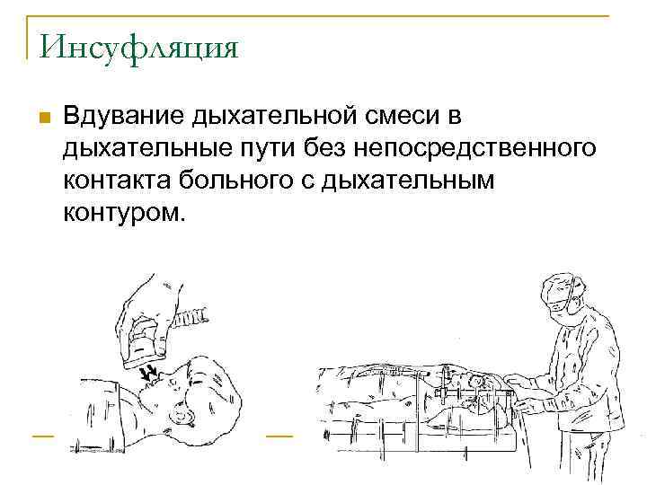 Инсуфляция n Вдувание дыхательной смеси в дыхательные пути без непосредственного контакта больного с дыхательным