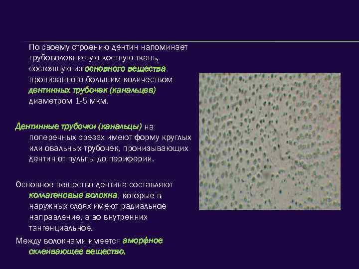 По своему строению дентин напоминает грубоволокнистую костную ткань, состоящую из основного вещества, пронизанного большим