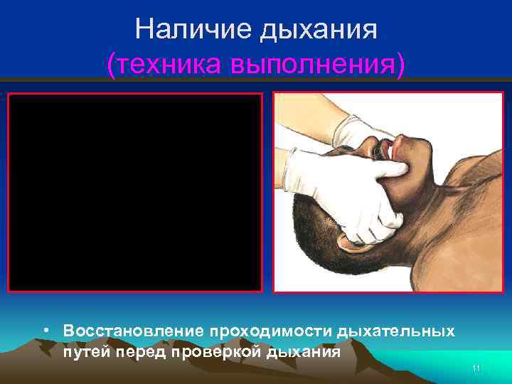 Наличие дыхания (техника выполнения) • Восстановление проходимости дыхательных путей перед проверкой дыхания 11 