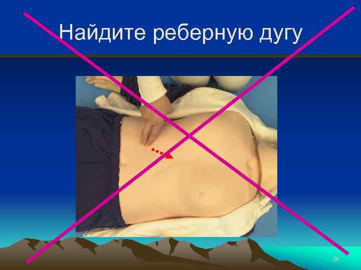 Найдите реберную дугу 24 