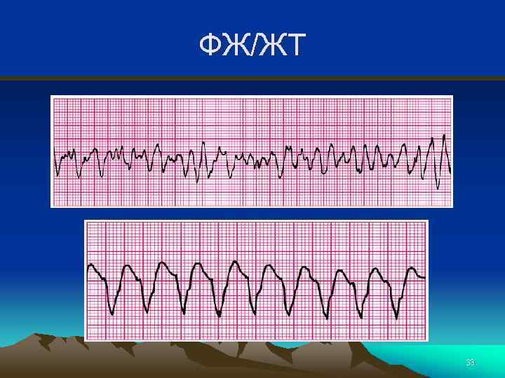 ФЖ/ЖТ 33 