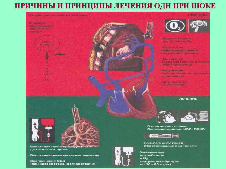 Основы интенсивной терапии и анестезиологии в схемах и таблицах