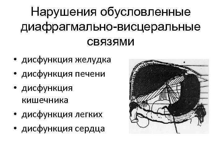 Нарушения обусловленные диафрагмально-висцеральные связями • дисфункция желудка • дисфункция печени • дисфункция кишечника •