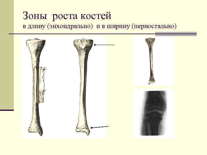Зоны роста костей в длину (энхондрально) и в ширину (периостально) 