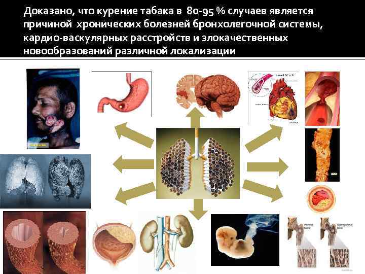 Доказано, что курение табака в 80 -95 % случаев является причиной хронических болезней бронхолегочной