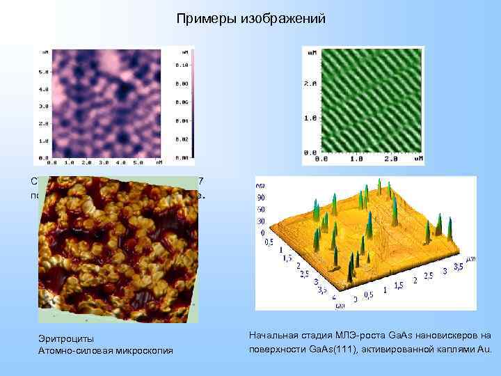 Изображения полученные с помощью. Сканирующая зондовая микроскопия СЗМ. Сканирующая зондовая микроскопия изображение. Атомно-силовая микроскопия снимки. Атомно-силовая микроскопия эритроцитов.