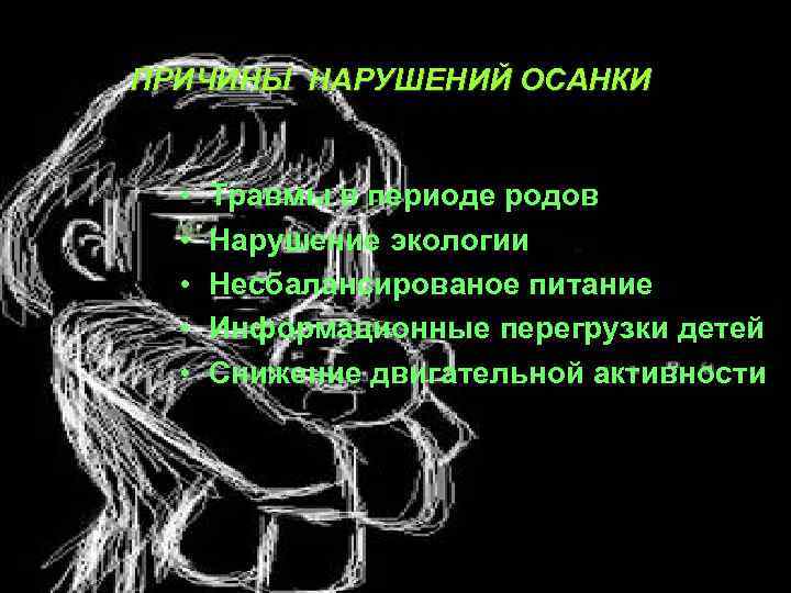 ПРИЧИНЫ НАРУШЕНИЙ ОСАНКИ • • • Травмы в периоде родов Нарушение экологии Несбалансированое питание
