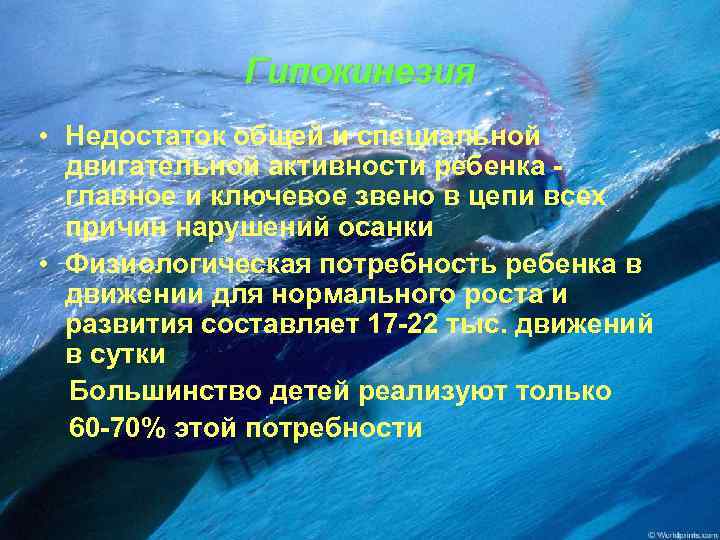 Гипокинезия • Недостаток общей и специальной двигательной активности ребенка главное и ключевое звено в