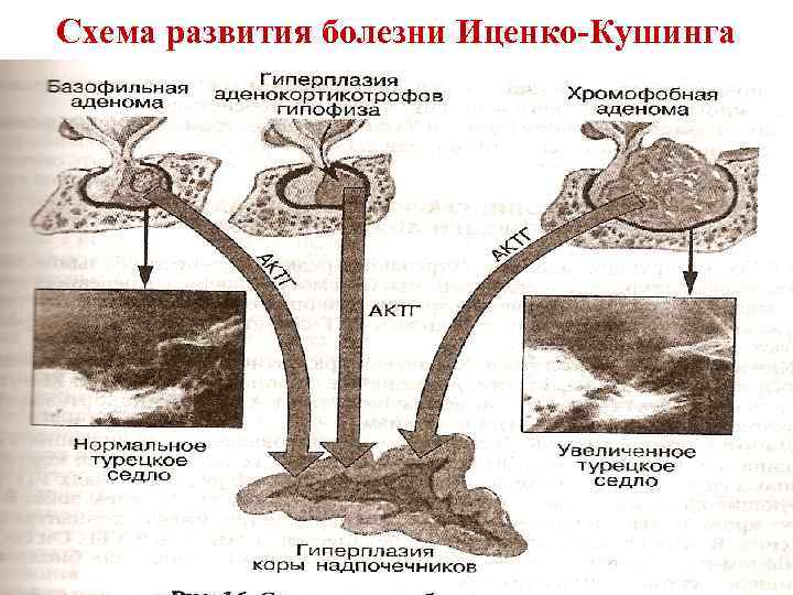 Схема развития заболевания. Схема развития болезни. Болезни гормонального профиля.