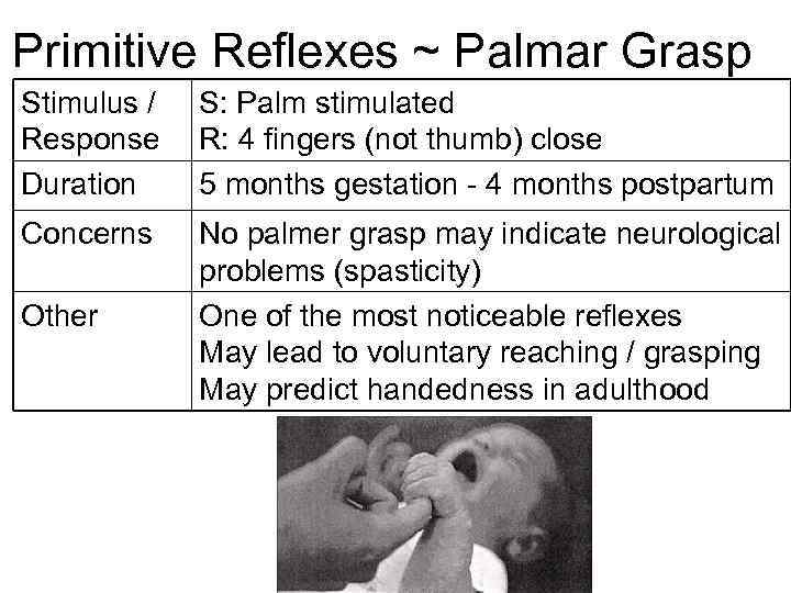 Primitive Reflexes ~ Palmar Grasp Stimulus / Response Duration S: Palm stimulated R: 4