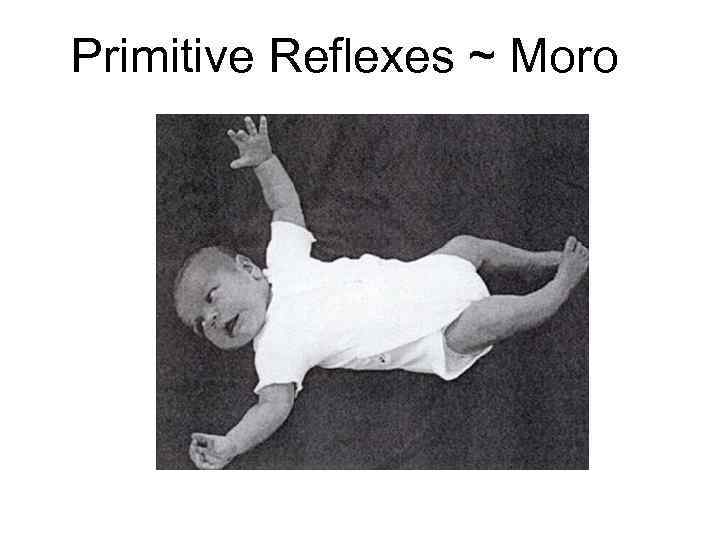 Primitive Reflexes ~ Moro 