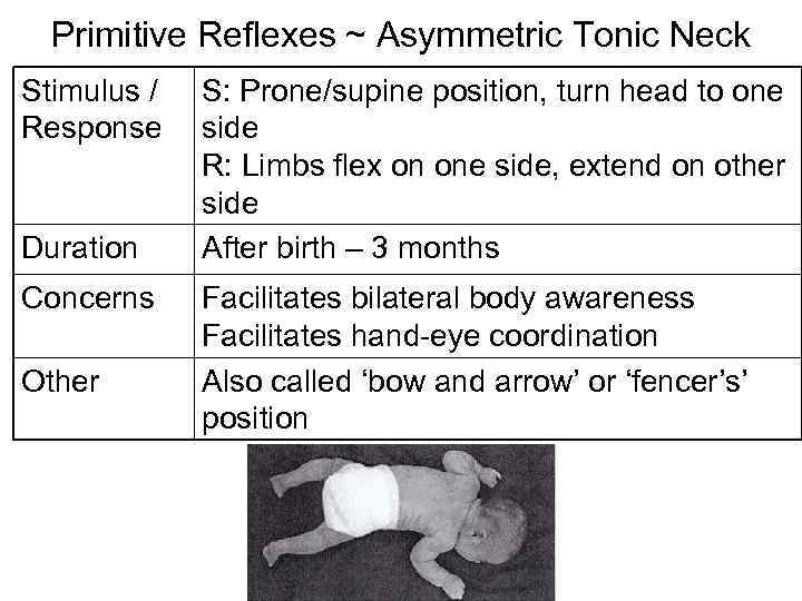 Primitive Reflexes ~ Asymmetric Tonic Neck Stimulus / Response Duration Concerns Other S: Prone/supine