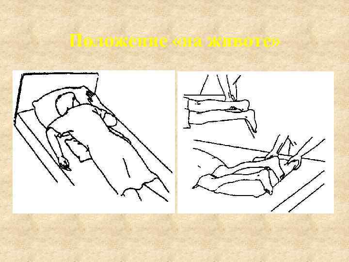 Положение «на животе» 