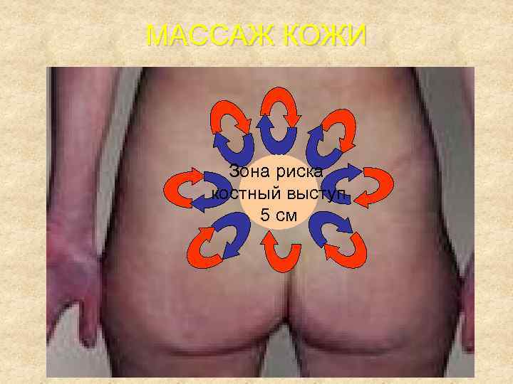 МАССАЖ КОЖИ (Уход за кожей) Зона риска костный выступ 5 см 