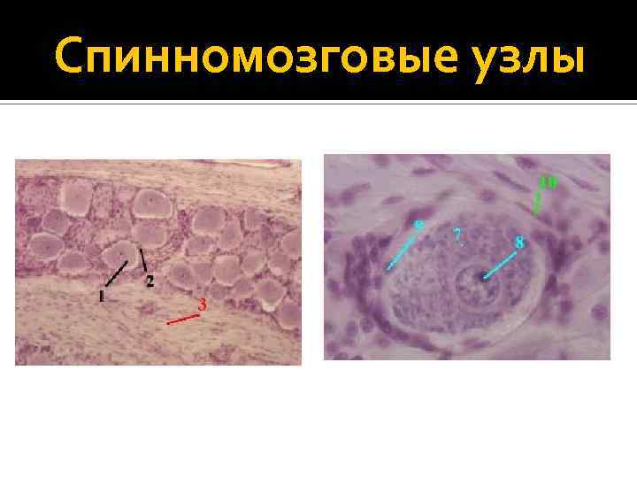 Спинномозговые узлы 