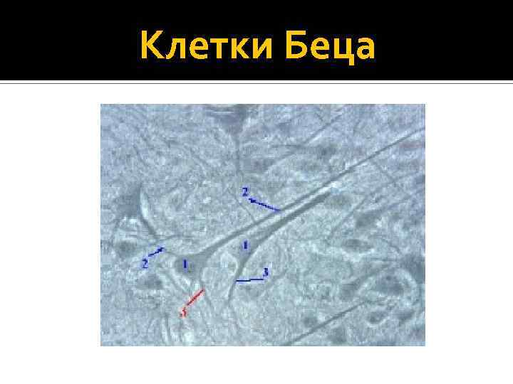 Клетки беца. Нейрон Беца. Гигантские пирамидные клетки Беца. Клетки Беца гистология. Клетки Беца строение.