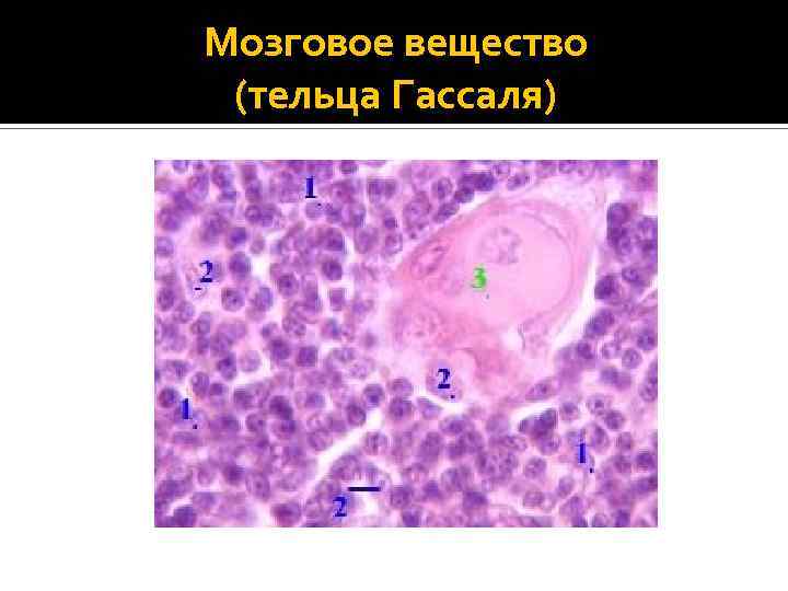 Мозговое вещество (тельца Гассаля) 