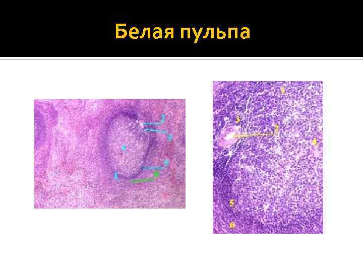 Белая пульпа 