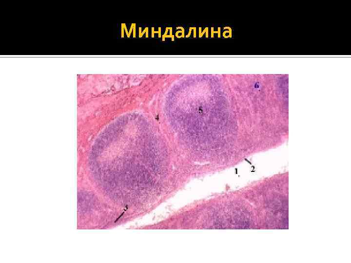 Миндалина 