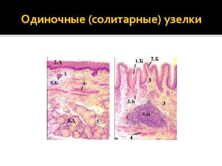 Одиночные (солитарные) узелки 