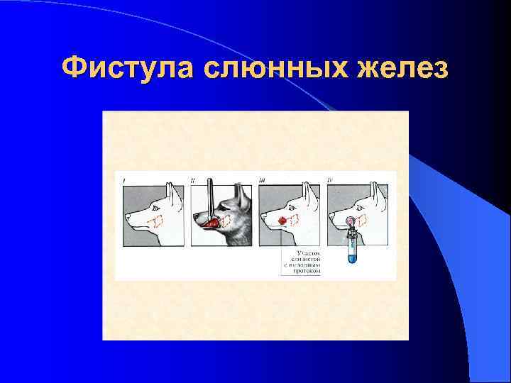 Фистула слюнных желез 