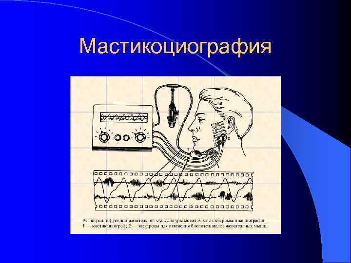 Мастикоциография 
