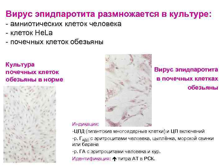 Вирус эпидпаротита размножается в культуре: - амниотических клеток человека - клеток He. La -