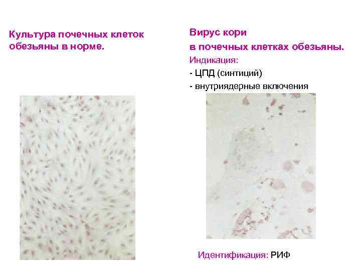 Культура почечных клеток обезьяны в норме. Вирус кори в почечных клетках обезьяны. Индикация: -