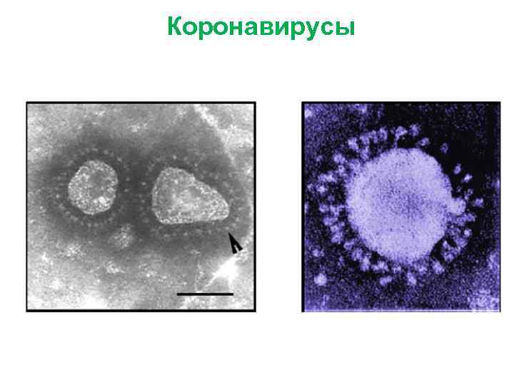 Ортомиксовирусы микробиология презентация