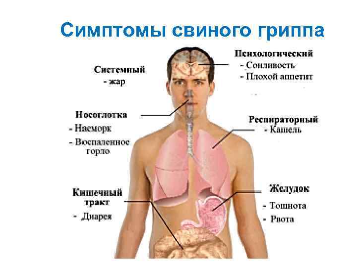 Симптомы свиного гриппа 