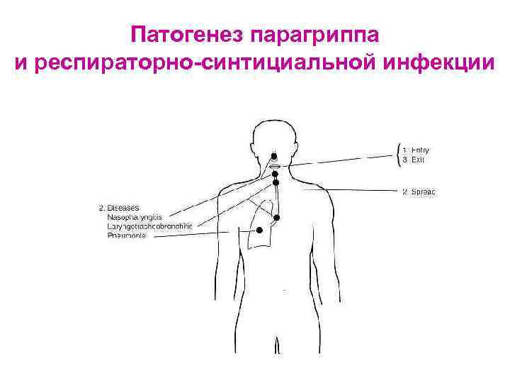 Парагрипп патогенез схема