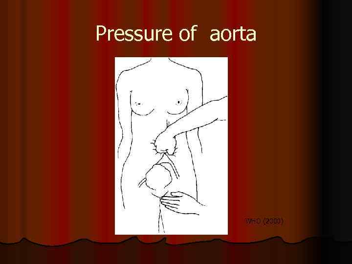 Pressure of aorta WHO (2000) 