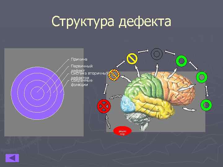 Структура дефекта при нарушении слуха схема