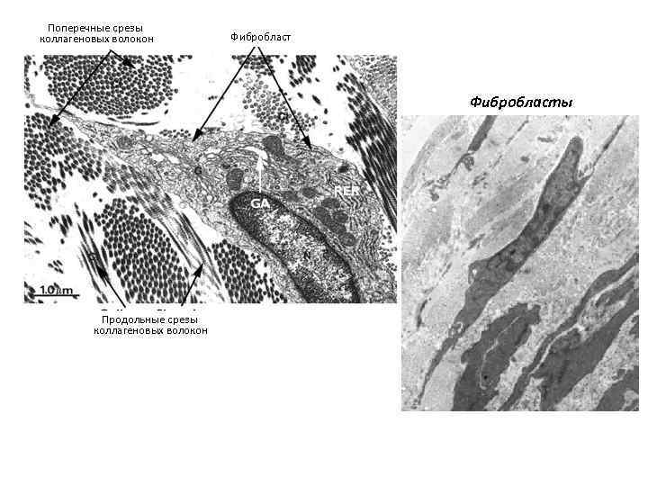 Поперечные срезы коллагеновых волокон Фибробласты Продольные срезы коллагеновых волокон 