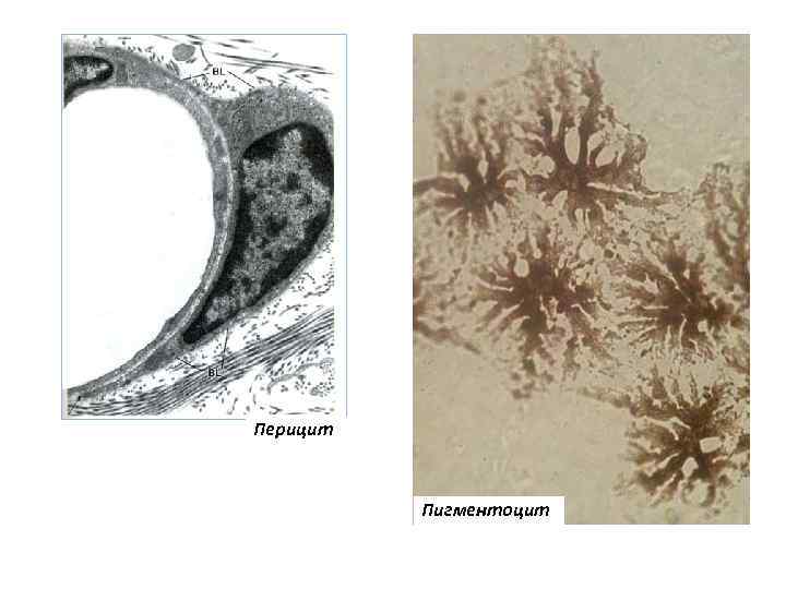 Перицит Пигментоцит 
