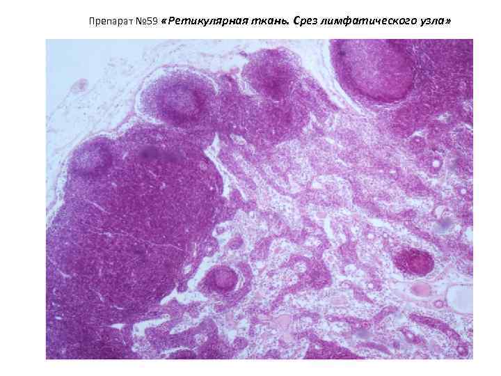 Препарат № 59 «Ретикулярная ткань. Срез лимфатического узла» 
