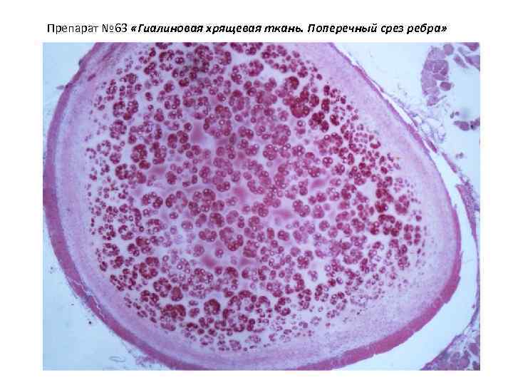 Препарат № 63 «Гиалиновая хрящевая ткань. Поперечный срез ребра» 