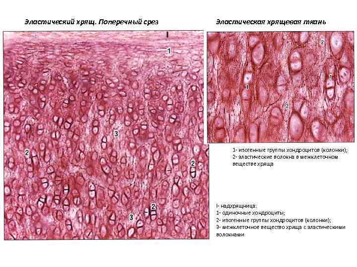 Эластический хрящ гистология рисунок