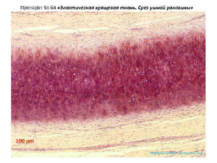 Препарат № 64 «Эластическая хрящевая ткань. Срез ушной раковины» 