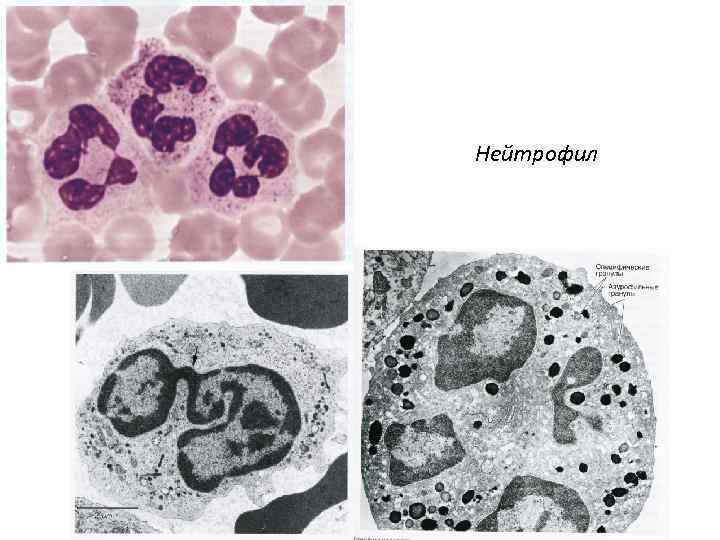 Нейтрофил 