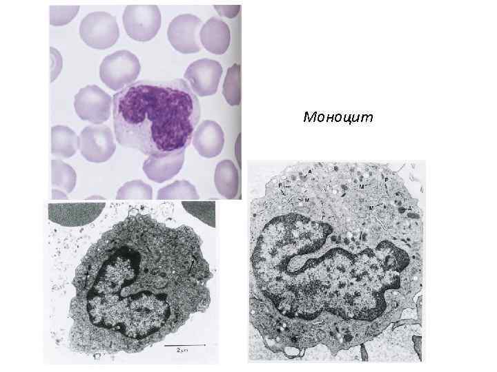 Моноцит 
