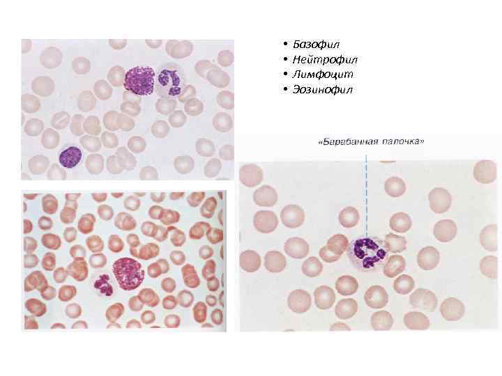  • • Базофил Нейтрофил Лимфоцит Эозинофил 