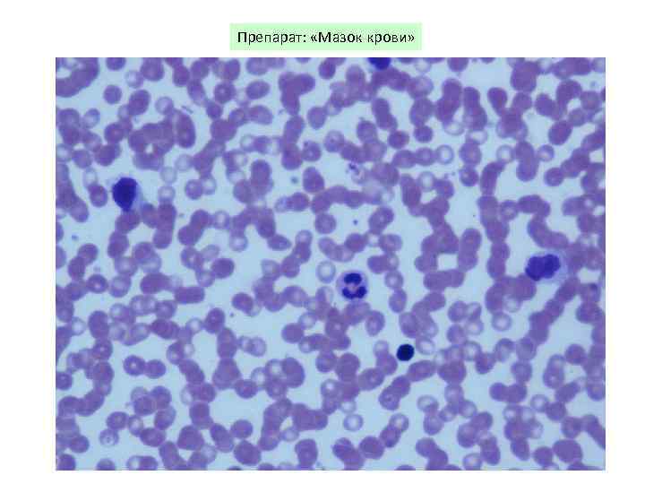 Препарат: «Мазок крови» 