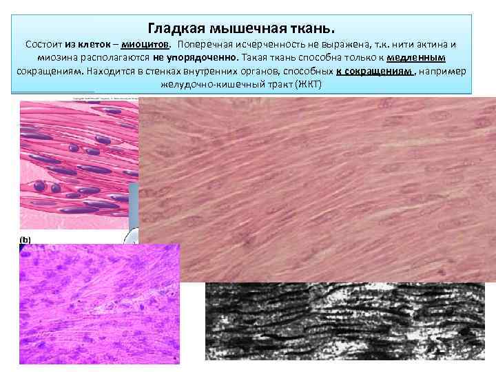 Гладкая мышечная ткань. Состоит из клеток – миоцитов. Поперечная исчерченность не выражена, т. к.