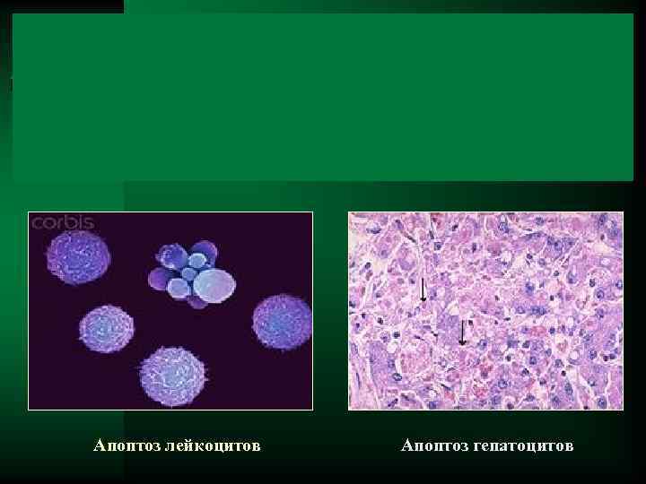 Тельце каунсильмена. Апоптоз клетки под микроскопом. Апоптоз клетки микроскоп. Апоптоз тканей.