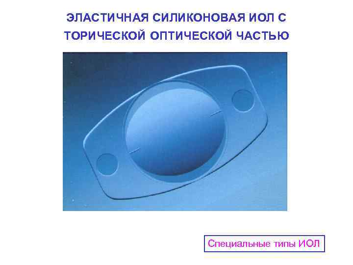 ЭЛАСТИЧНАЯ СИЛИКОНОВАЯ ИОЛ С ТОРИЧЕСКОЙ ОПТИЧЕСКОЙ ЧАСТЬЮ Специальные типы ИОЛ 